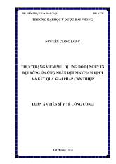 Luận án Thực trạng viêm mũi dị ứng do dị nguyên bụi bông ở công nhân dệt may Nam Định và kết quả giải pháp can thiệp